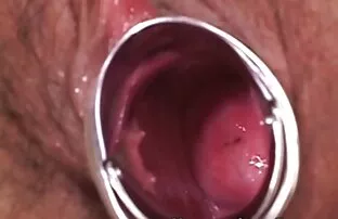 XXX ब्राजील गांठ गंजा सोनाक्षी सिन्हा सेक्सी वीडियो पिक्चर आदमी था एक तंग बिंदु